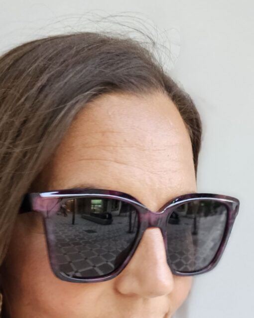 Gafas Astra - Imagen 3